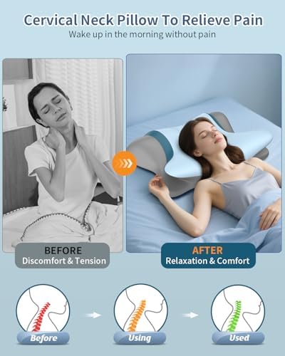 Cervical Pillow for Neck Pain Relief, Ergonomic Neck Pillow for Sleeping - Image 2