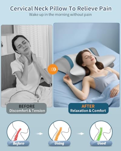 Cervical Pillow for Neck Pain Relief, Ergonomic Neck Pillow for Sleeping - Image 2