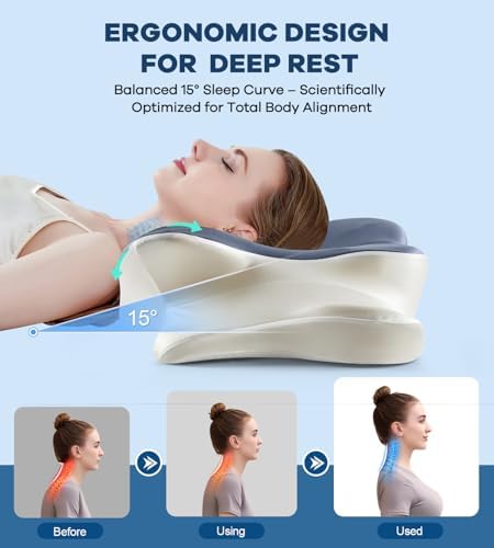 DONAMA Cervical Pillow for Neck and Shoulder Pain Relief, Cooling Contour - Image 2