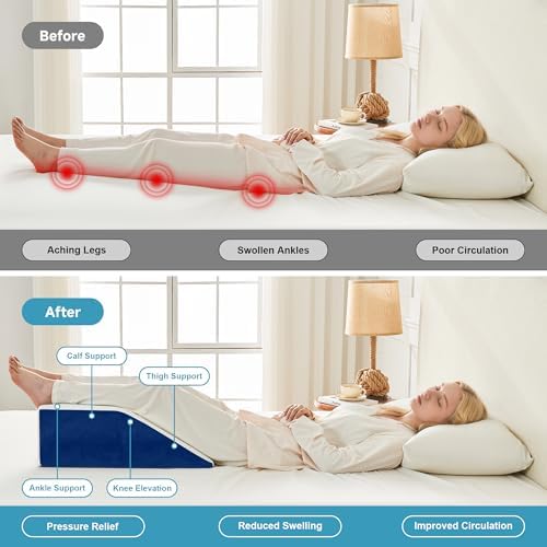 Yojoker Leg Elevation Pillows for Swelling, Memory Foam Wedge Pillow for Legs - Image 3