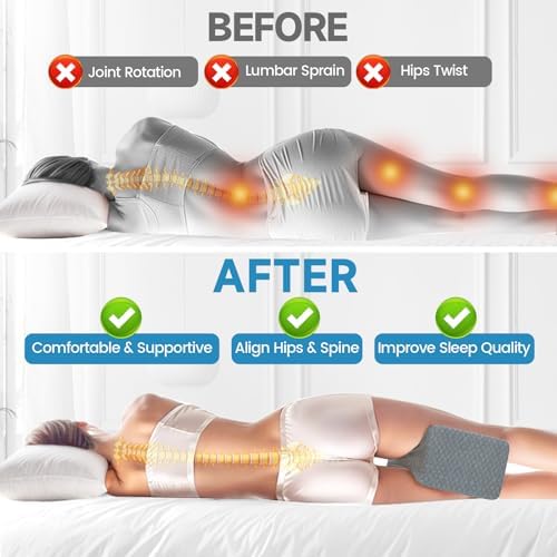 SweetSlubr Memory Foam Knee Pillow - Image 4