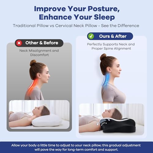 DONAMA Cervical Pillow for Neck Pain, Ergonomic Memory Foam Contour Pillow - Image 2