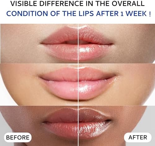 Lip Sleeping Mask, Collagen Lip Mask Overnight, Lip Plumper - Image 3