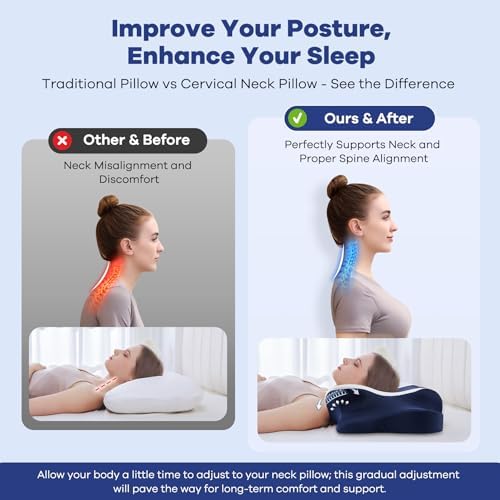 DONAMA Cervical Pillow for Neck Pain, Ergonomic Memory Foam Contour Pillow - Image 4