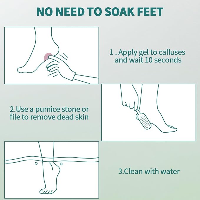 Gorgellux Callus Remover Gel, Callus Remover - Image 4