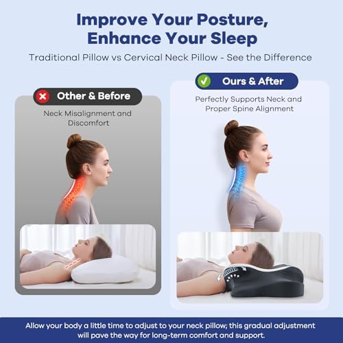 DONAMA Cervical Neck Pillow for Pain Relief, Memory Foam Ergonomic Pillows - Image 3