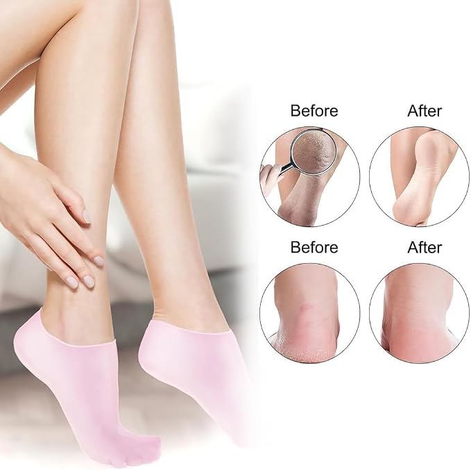 2 Pairs Silicone Moisturizing Glove Socks Set - Image 6