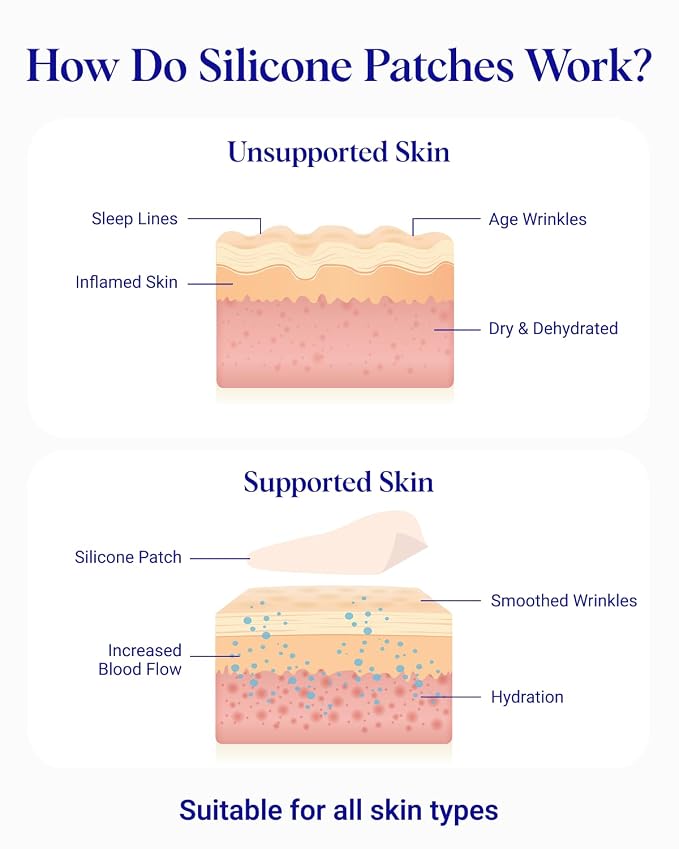 Wrinkles Schminkles Under Eye Wrinkle Patches | Smooth Eye Wrinkles, Crows Feet - Image 4