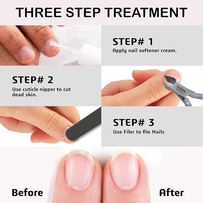 Professional Cuticle Trimmer Nail Cuticle Cutter Stainless Steel Cuticle Nippers - Image 7