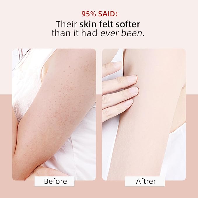 KP Bump Eraser Body Scrub with 10% AHA BHA Ingrown Hair Keratosis Pilaris Razor - Image 2