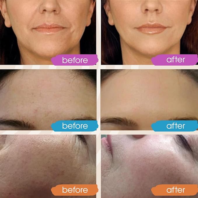 GLEOW Vitamin C Face Serum, Hydrating Vitamin C Serum - Image 3