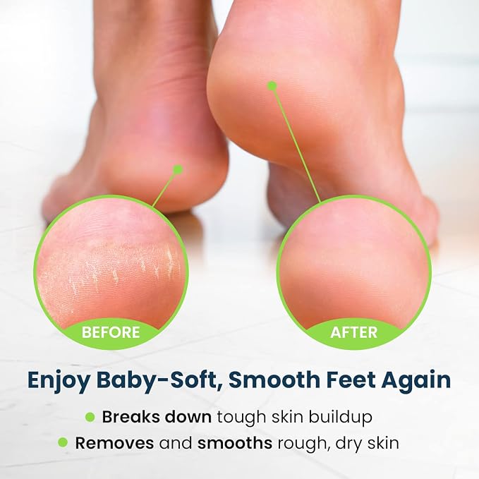 Toenail Fungus Treatment Extra Strength - Image 8