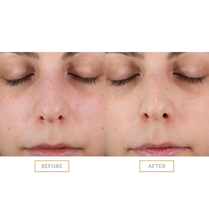 Clarisonic Sonic Face Exfoliator Cleansing Brush Head | Gentle Exfoliating - Image 4