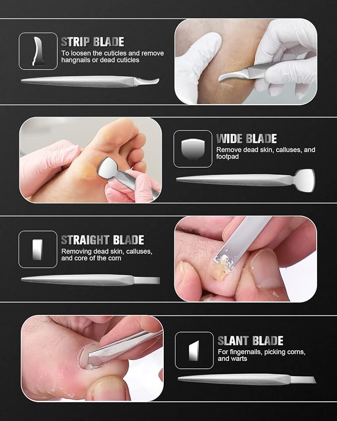 FERYES Pedicure Knife Ingrown Toenail Kit, Top Notch Foot Blade, Super Sharp - Image 4