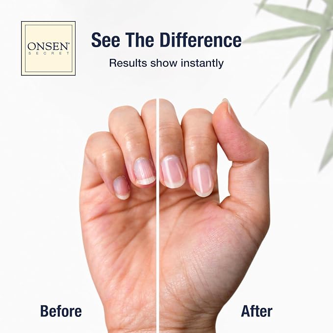 Onsen Secret Ultimate Nail Reboot Kit - Image 2