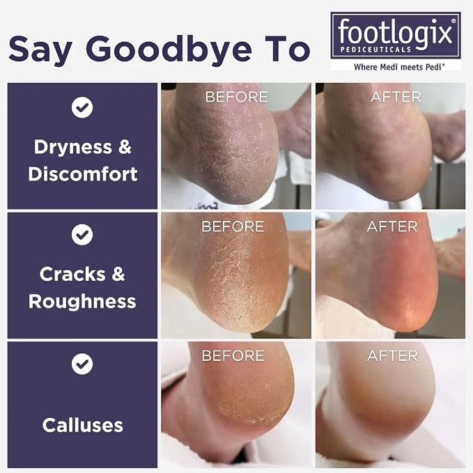 FOOTLOGIX Double Sided File - Image 2