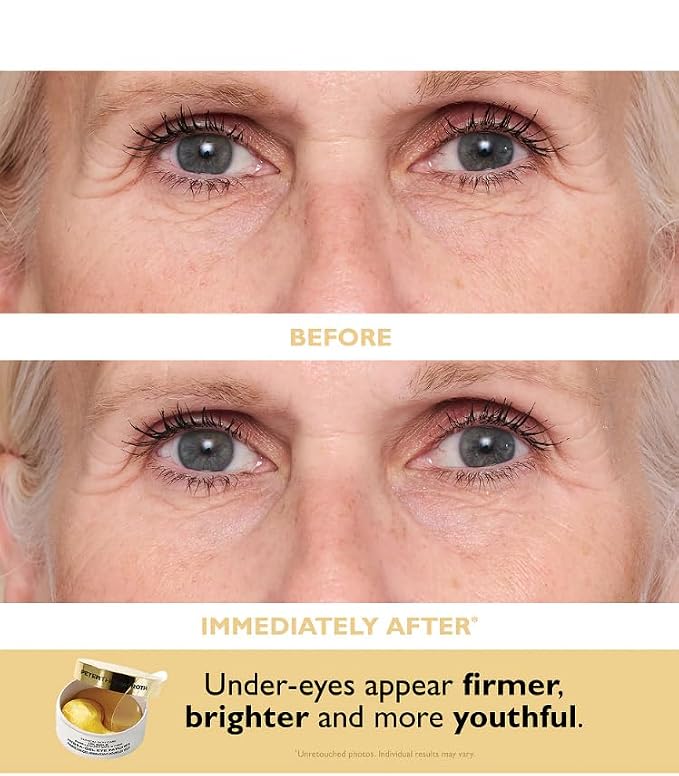 Peter Thomas Roth | Patch + Go Eye Patch Travel Pack - Image 6