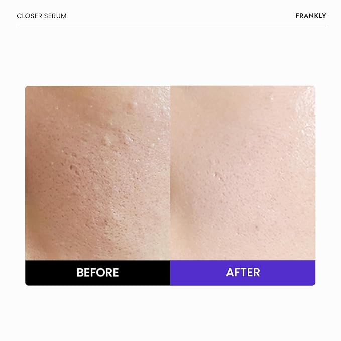 FRANKLY Closer Serum Mega Jumbo | Pore Minimizer Serum | 9 Peptides, Vegan - Image 2