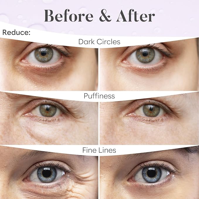 BLOOMORA Retinol & Collagen Under Eye Patches - Image 4