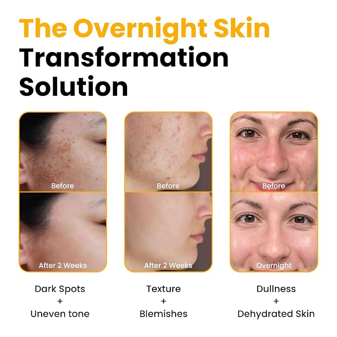 QUIA Turmeric + Kojic Acid Overnight Wrapping Mask – Hydration Mask - Image 3