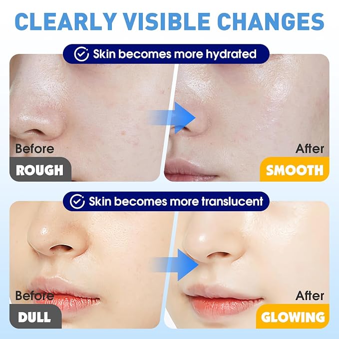 KONEUK 9 Pack Hydrating Face Masks Skincare, Bulk Sheet Face Mask - Image 6