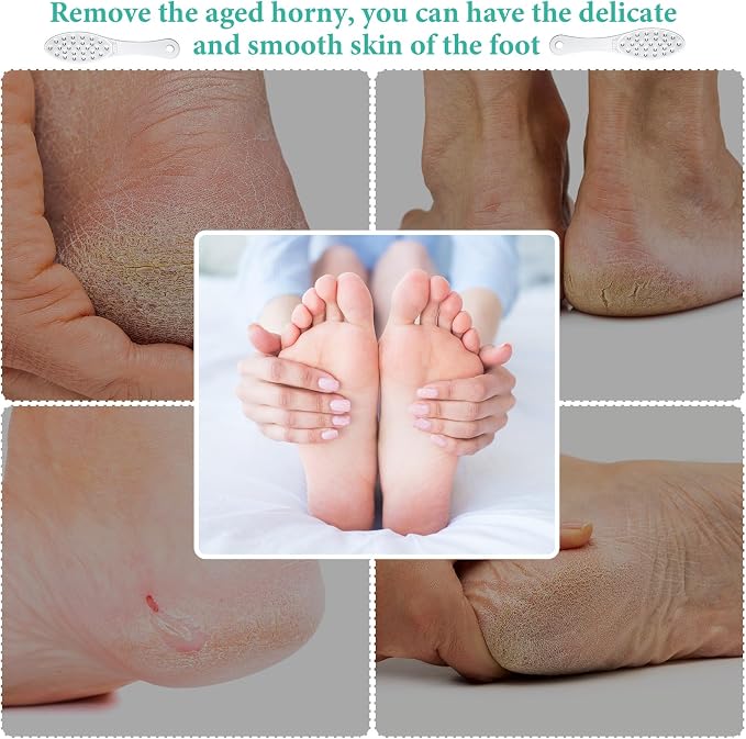 4 Pcs Stainless Steel Foot File Callus Remover Double Sided Metal Foot Rasp - Image 6