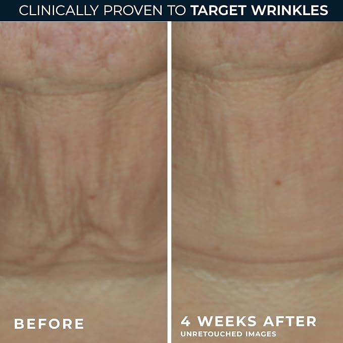 RoC Derm Correxion Retinol Firming Serum Stick - Image 4