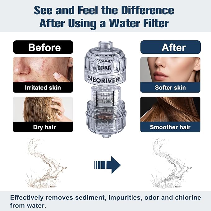 High Output Revitalizing Shower Filter - Image 6