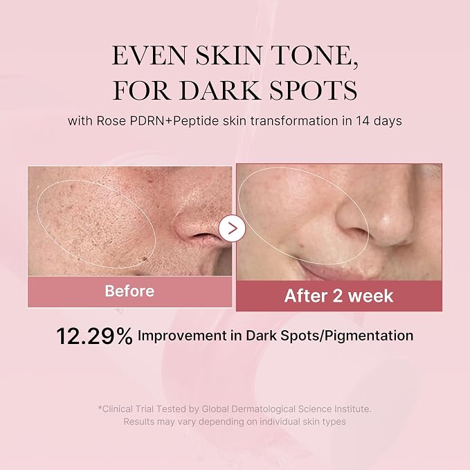 medicube PDRN Toner Rose PDRN Peptide Toner | Lightweight & Watery Type - Image 2