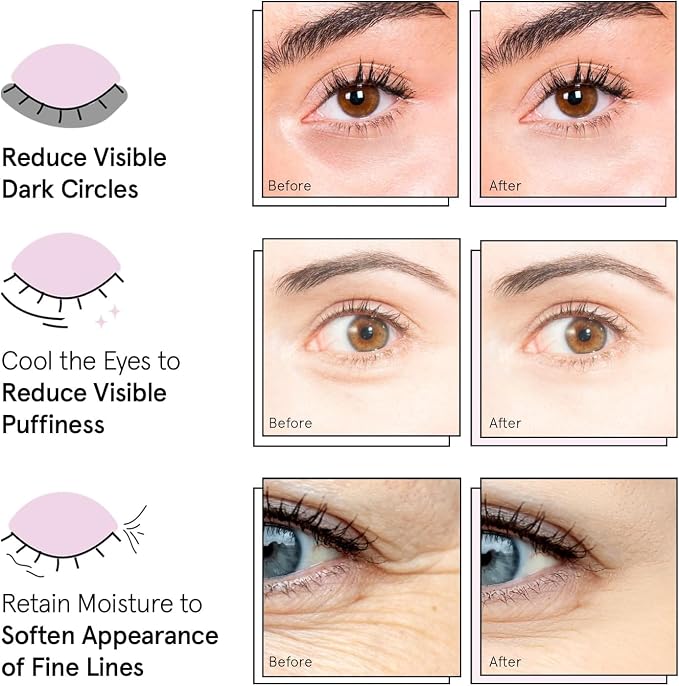grace & stella Award Winning Under Eye Mask - Image 7