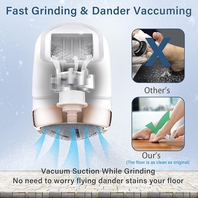 Hoxida Electric Callus Remover for Feet, Rechargeable Foot Pedicure Tools Foot - Image 4