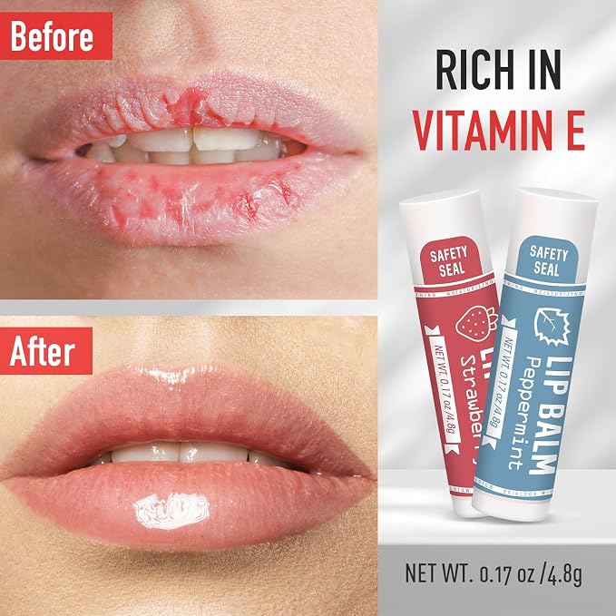 AZEN 240 Pack Lip Balm, Natural Lip Balm Bulk, Lip Care Product, Moisturizing - Image 4