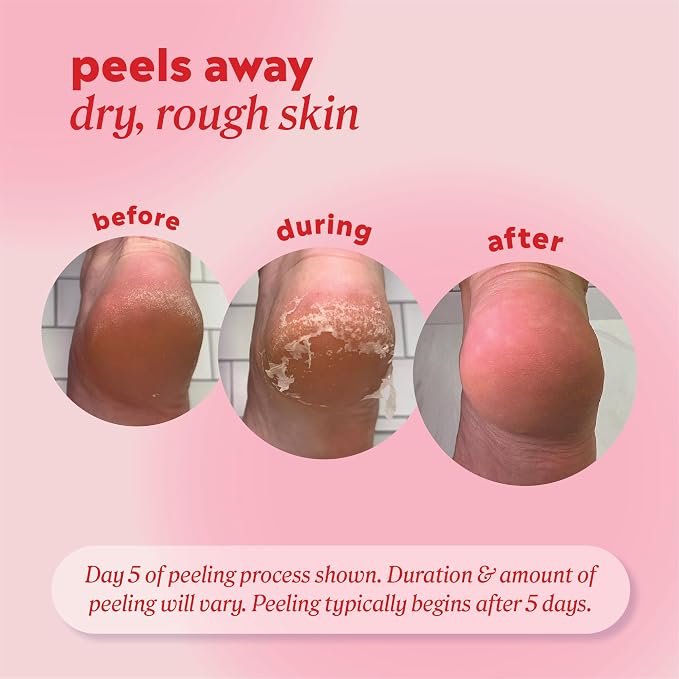 Onyx Professional Foot Peel Mask Callus Remover, 2 pack - Image 4