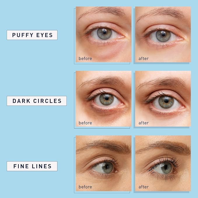 Enaskin Naturals Under Eye Patches - Image 7