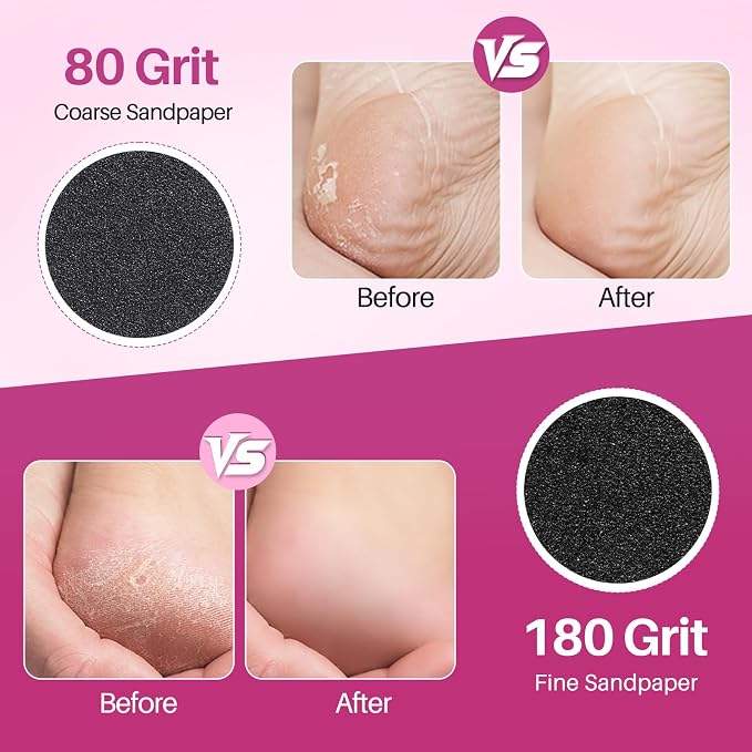 Replaceable Sandpaper for Electric Foot File: 120 Pcs/2 Box Feet Grinder for - Image 5