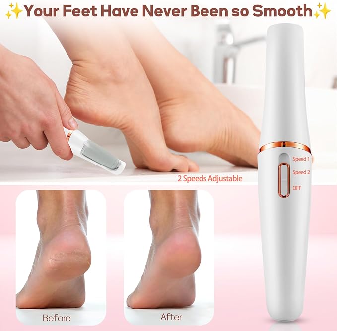 ZABOUL Electric Foot Callus Remover Rechargeable Portable Electric Foot File - Image 3