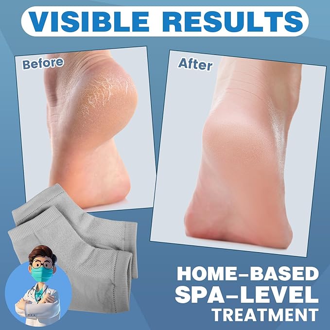 TEAWOO Moisturizing Toeless Socks - Image 2