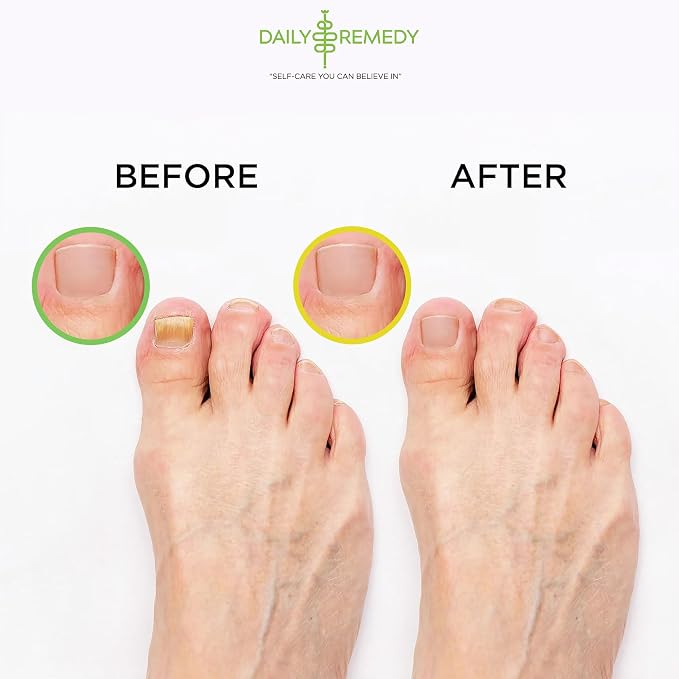 DAILY REMEDY EXTRA STRENGTH Tea Tree Oil & Citrus Detox Foot Soak Set - Image 6