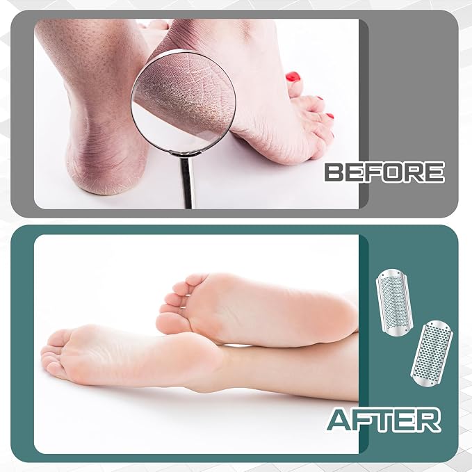 Moxweyeni 14 Pack Colossal Foot File Pedicure Tools Sets - Image 5