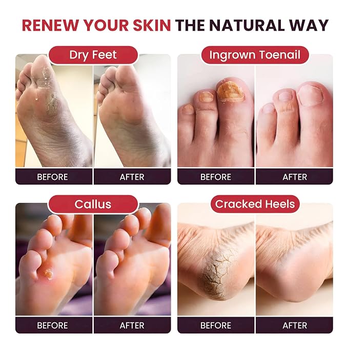 FOOT CURE Muscle Care Foot Soak - Image 5