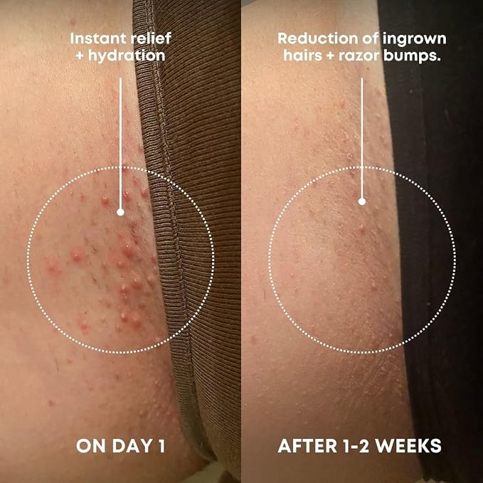Bushbalm Ingrown Hair Exfoliating Scrub – Pre-Shave Sugar Scrub - Image 2