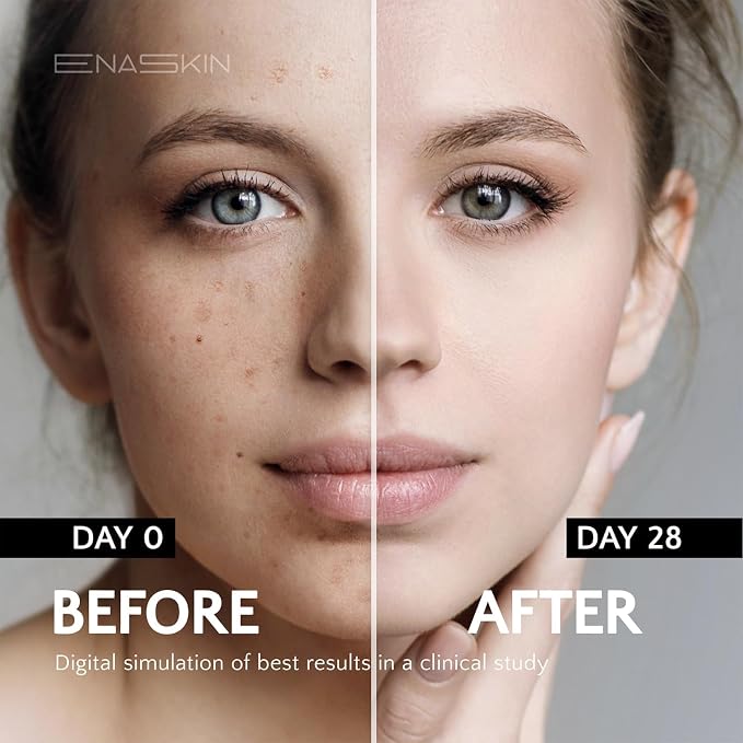 EnaSkin Dark Spot Remover for Face and Body: Advanced Formula Spot Corrector - Image 4