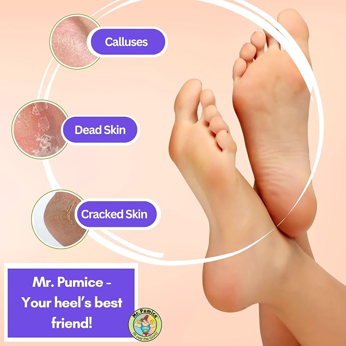 Mr. Pumice Ultimate PUMI Bar 2-in-1 Dual Grit Callus Remover, Pedicure Stone & - Image 5