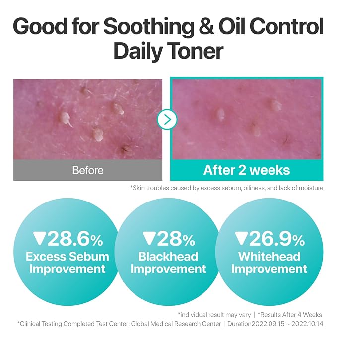 numbuzin No.1 Toner | Pure-Full Calming Herb Toner | Breakouts, Excess Oil - Image 3