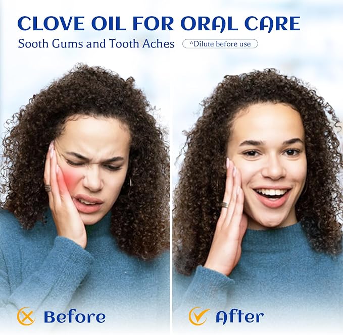 HIQILI 100ML Clove Oil for Teeth and Gums, Tooth Aches, Aromatherapy, 100% Pure - Image 2