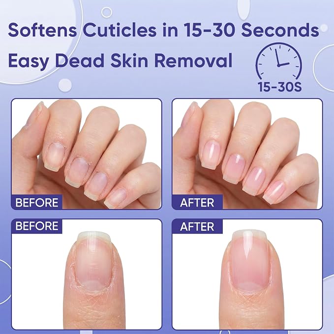 Cuticle Care Kit - Image 6