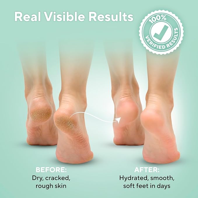 Tea Tree Oil Foot Soak and 40% Urea Cream - Image 5