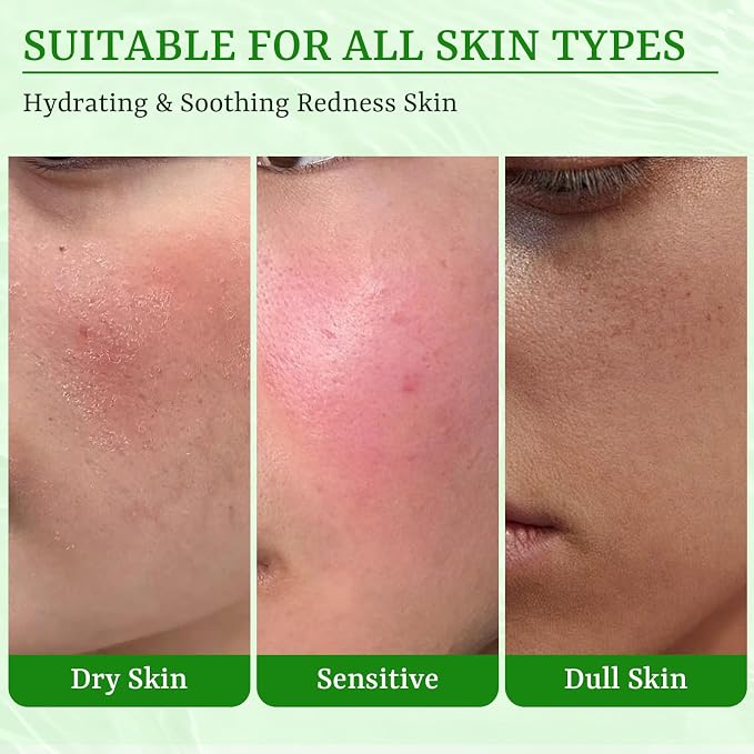 Aloe Vera Face Masks Skincare Soothing & Hydrating Face Masks Aloe Face Mask - Image 4