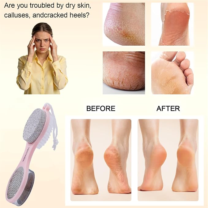 Foot File Callus Remover 5-in-1, Scrubber Brush, Stainless Steel Foot Rasp and - Image 3
