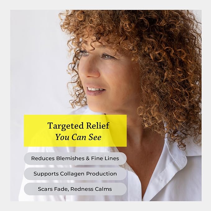 Silk Road Organic Helichrysum Italicum Essential Oil Roll on - Image 2